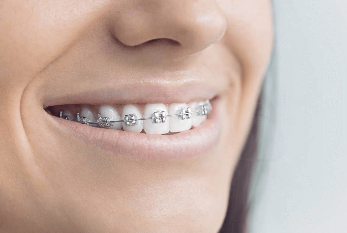 orthodontists greenwich london fixed braces